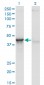 ACY1 Antibody (monoclonal) (M01)
